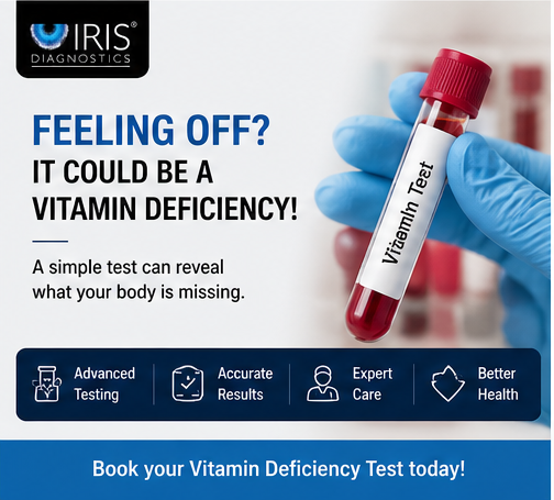 lab test hyderabad