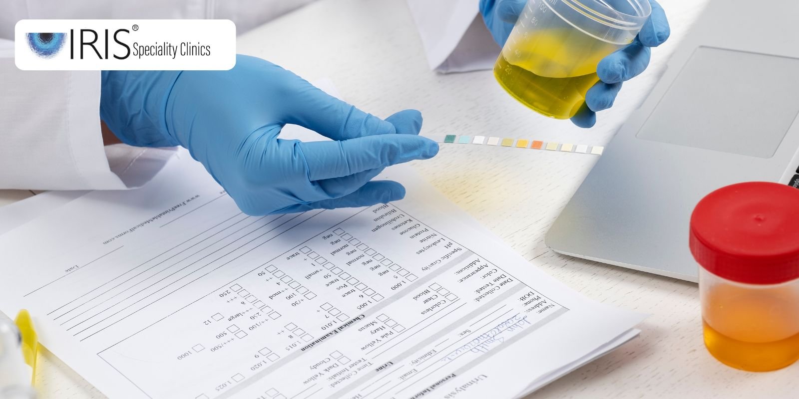 urine culture test tolichowki