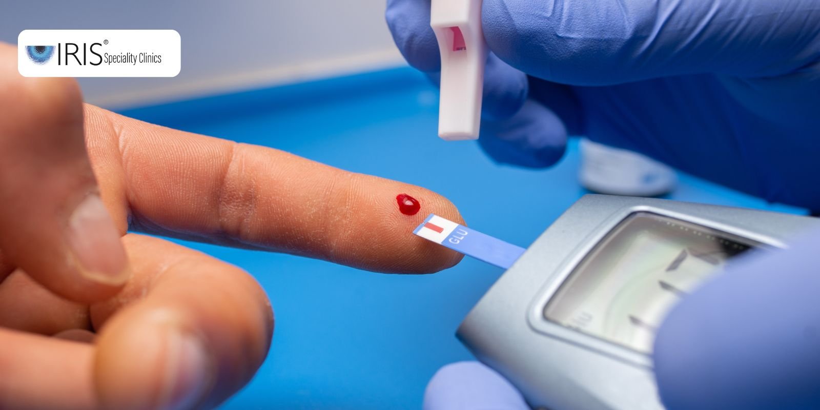 urine culture test tolichowki