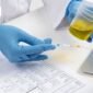 Lab Test Hyderabad 4 85x85