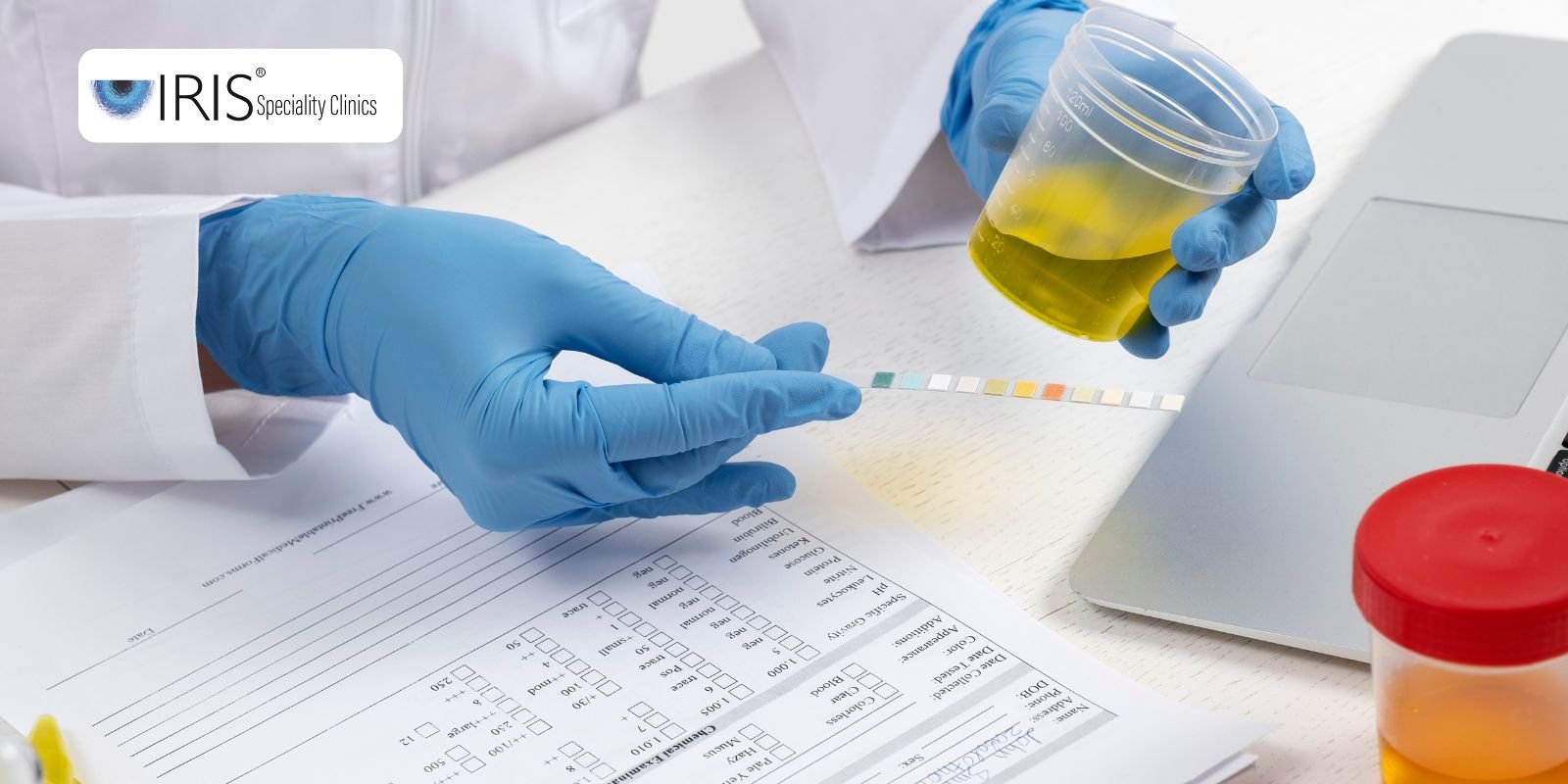 Lab Test Hyderabad