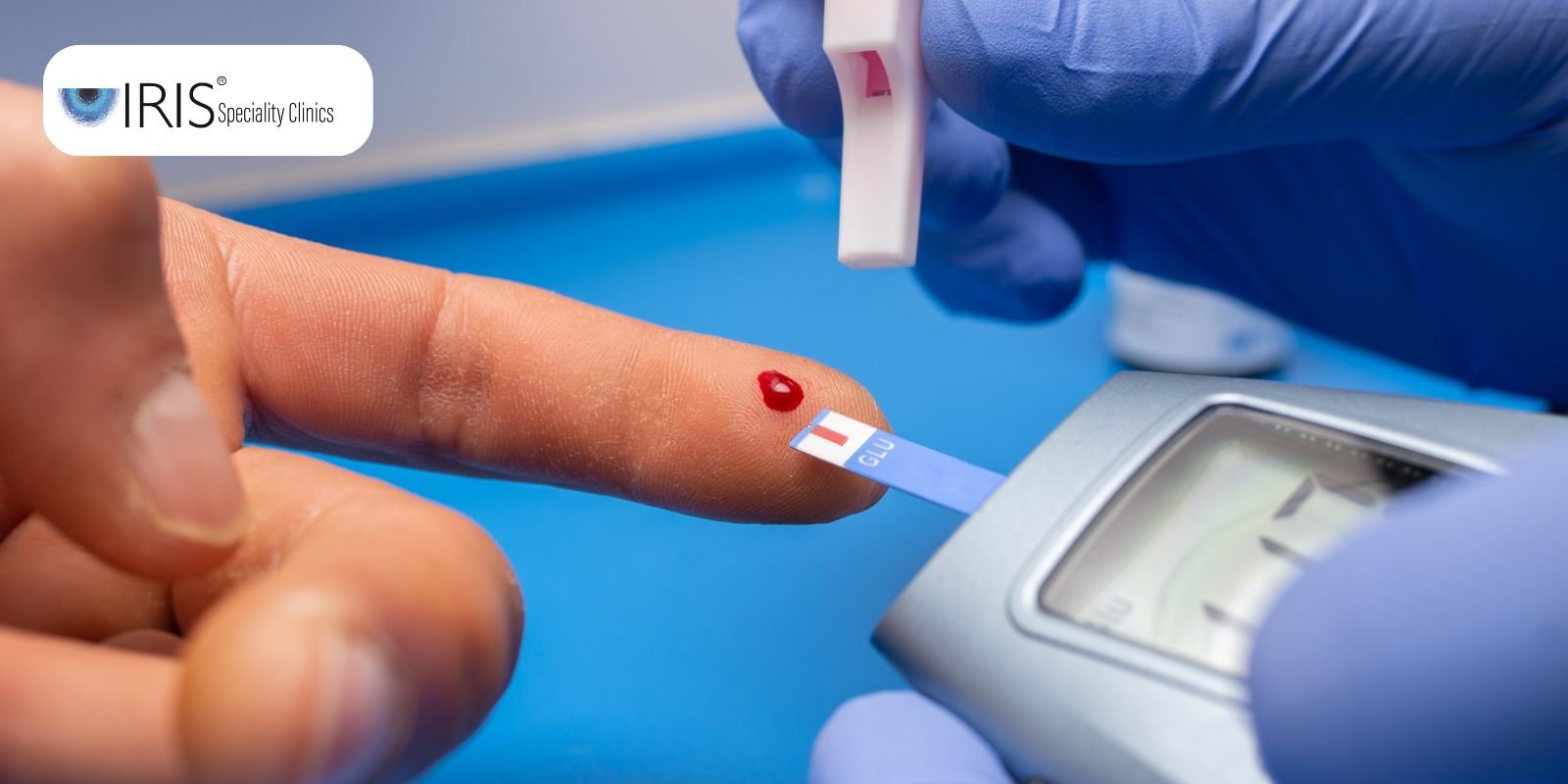 sugar test hyderabad