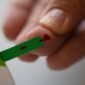 sugar test hyderabad
