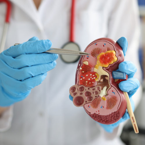 best urologist in hyderabad