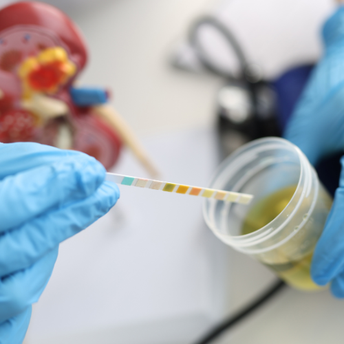 best urologist in hyderabad