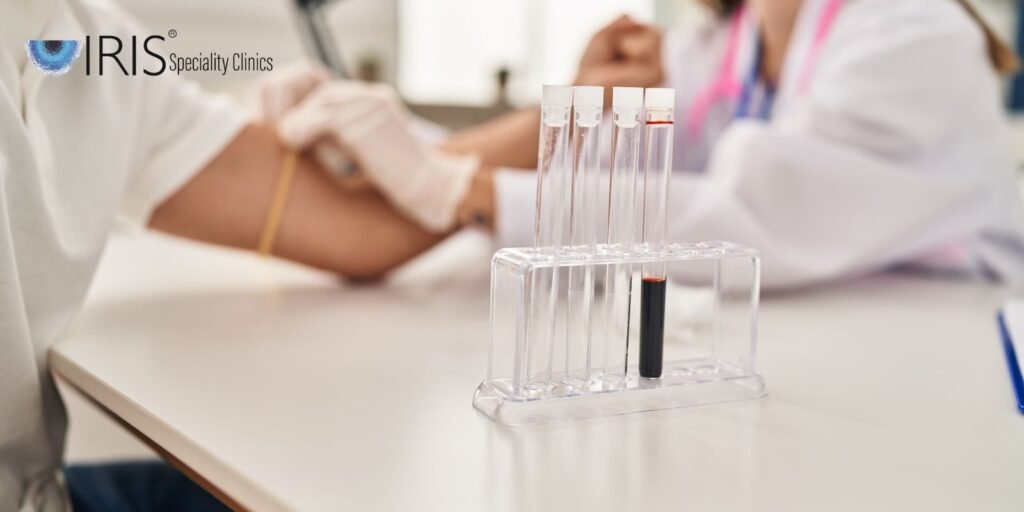 Lab Test Hyderabad