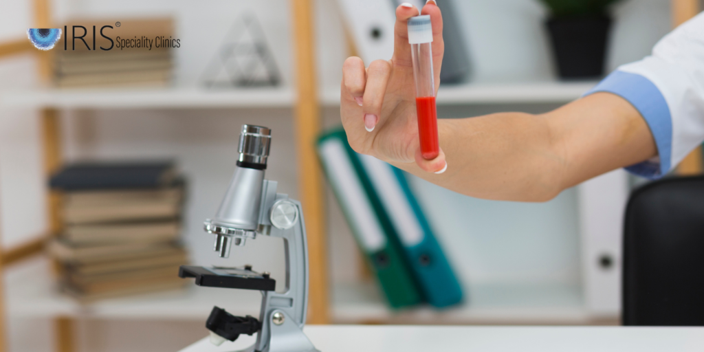 Lab test Hyderabad