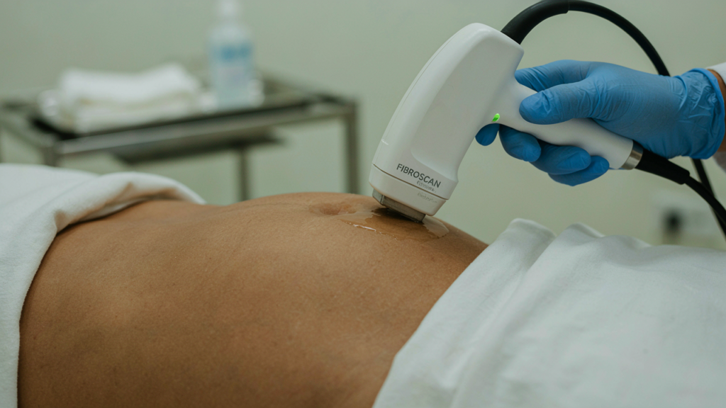 fibroscan in Hyderabad